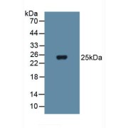 Western blot analysis of Human Blood Cells.