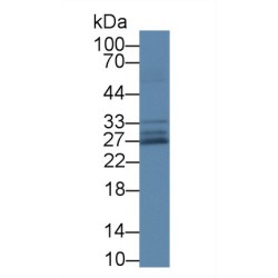 Superoxide Dismutase 3 (SOD3) Antibody