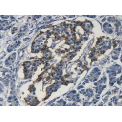 Superoxide Dismutase 3 (SOD3) Antibody