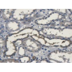 Superoxide Dismutase 3 (SOD3) Antibody