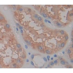 Thymus Activation Regulated Chemokine (TARC) Antibody