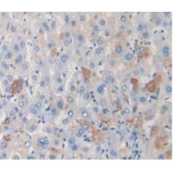 Thymus Activation Regulated Chemokine (TARC) Antibody