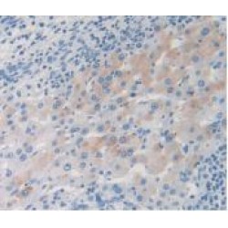 Thymus Activation Regulated Chemokine (TARC) Antibody