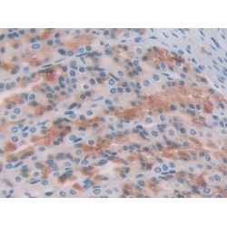 Thymus Activation Regulated Chemokine (TARC) Antibody