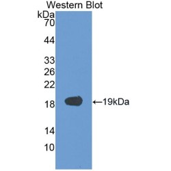 Vascular Endothelial Growth Factor A (VEGFA) Antibody