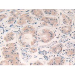 Vascular Endothelial Growth Factor A (VEGFA) Antibody