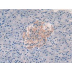 Vascular Endothelial Growth Factor A (VEGFA) Antibody