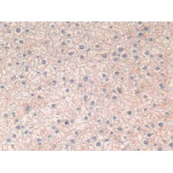 Vascular Endothelial Growth Factor A (VEGFA) Antibody