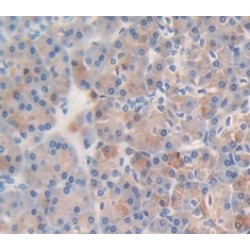 Vascular Endothelial Growth Factor B (VEGFB) Antibody