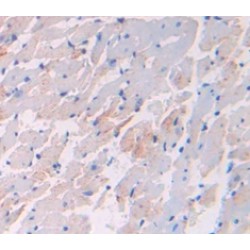 Vascular Endothelial Growth Factor B (VEGFB) Antibody