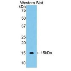 Vascular Endothelial Growth Factor C (VEGFC) Antibody