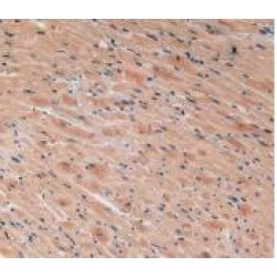 Vascular Endothelial Growth Factor C (VEGFC) Antibody