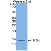 Western blot analysis of the recombinant protein.