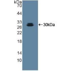 A Disintegrin And Metalloprotease 10 (ADAM10) Antibody