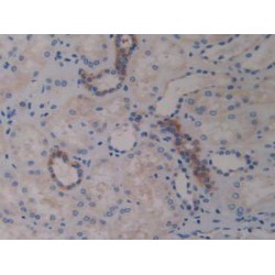 A Disintegrin And Metalloprotease 10 (ADAM10) Antibody