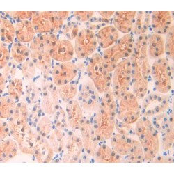 A Disintegrin And Metalloprotease 10 (ADAM10) Antibody