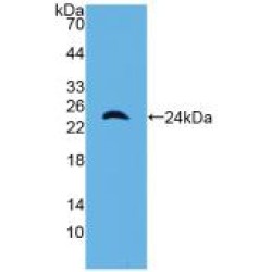 Alpha-1-Microglobulin / Bikunin Precursor (a1M) Antibody