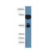 Western blot analysis of Rat Serum, using Rat a1M Antibody (1 µg/ml) and HRP-conjugated Goat Anti-Rabbit antibody (<a href="https://www.abbexa.com/index.php?route=product/search&amp;search=abx400043" target="_blank">abx400043</a>, 0.2 µg/ml).