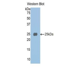 Alpha-1-Microglobulin / Bikunin Precursor (a1M) Antibody