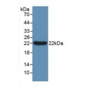 Western blot analysis of recombinant Human Bcl2L2.