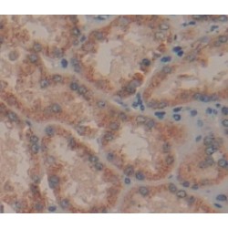 B-Cell CLL/Lymphoma 2 Like Protein 2 (Bcl2L2) Antibody