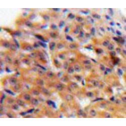 C-C Motif Chemokine 27 (CCL27) Antibody