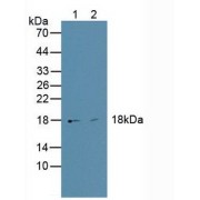 Western blot analysis of (1) Human HepG2 Cells and (2) Human BXPC-3 Cells.