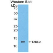 Western blot analysis of the recombinant protein.