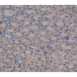 High Mobility Group Protein HMG-I / HMG-Y (HMGA1) Antibody