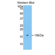 Western blot analysis of the recombinant protein.