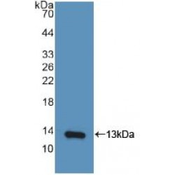 C-X-C Motif Chemokine 10 (CXCL10) Antibody