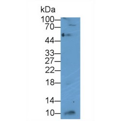 C-X-C Motif Chemokine 10 (CXCL10) Antibody