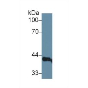 Western blot analysis of Rat Serum, using Rat LEDGF Antibody (1 µg/ml) and HRP-conjugated Goat Anti-Rabbit antibody (<a href="https://www.abbexa.com/index.php?route=product/search&amp;search=abx400043" target="_blank">abx400043</a>, 0.2 µg/ml).