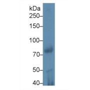 Western blot analysis of Rat Testis lysate, using Mouse iPLA2 Antibody (1 µg/ml) and HRP-conjugated Goat Anti-Rabbit antibody (<a href="https://www.abbexa.com/index.php?route=product/search&amp;search=abx400043" target="_blank">abx400043</a>, 0.2 µg/ml).