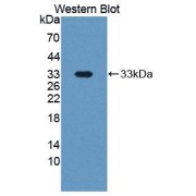 Western blot analysis of recombinant Human PAPPA.