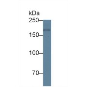 Western blot analysis of Human Placenta lysate, using Human PAPPA Antibody (1 µg/ml) and HRP-conjugated Goat Anti-Rabbit antibody (<a href="https://www.abbexa.com/index.php?route=product/search&amp;search=abx400043" target="_blank">abx400043</a>, 0.2 µg/ml).