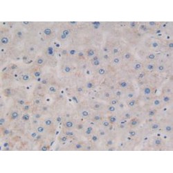 Antiviral Innate Immune Response Receptor RIG-I (RIGI) Antibody