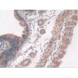 Antiviral Innate Immune Response Receptor RIG-I (RIGI) Antibody