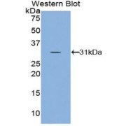 Western blot analysis of the recombinant protein.