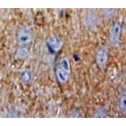 Superoxide Dismutase Copper Chaperone (CCS) Antibody