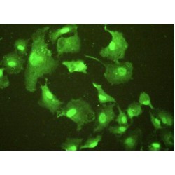 Epithelial Cell Transforming Sequence 2 (ECT2) Antibody