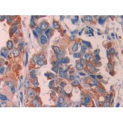 Epithelial Cell Transforming Sequence 2 (ECT2) Antibody