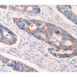 Epithelial Cell Transforming Sequence 2 (ECT2) Antibody