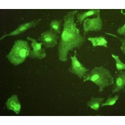 Epithelial Cell Transforming Sequence 2 (ECT2) Antibody