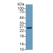 Western blot analysis of Mouse Liver lysate, using Mouse GSTm2 Antibody (1 µg/ml) and HRP-conjugated Goat Anti-Rabbit antibody (<a href="https://www.abbexa.com/index.php?route=product/search&amp;search=abx400043" target="_blank">abx400043</a>, 0.2 µg/ml).