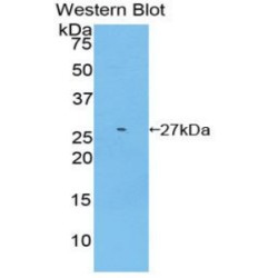 Glutathione S Transferase Mu 2, Muscle (GSTm2) Antibody