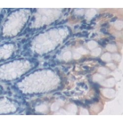 Glutathione S Transferase Mu 2, Muscle (GSTm2) Antibody