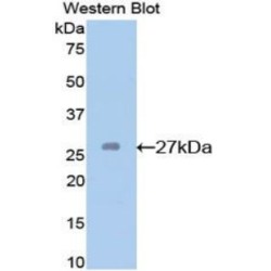 Glutathione S Transferase Mu 2, Muscle (GSTm2) Antibody