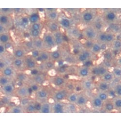 Glutathione S Transferase Mu 2, Muscle (GSTm2) Antibody