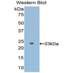 Interleukin 1 Receptor Like Protein 1 (IL1RL1) Antibody